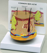 Skin Acne Pharmaceutical and Anatomical Model Gifts